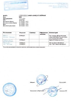 Купить анализ на ВИЧ, RW (сифилис), гепатиты в Москве.